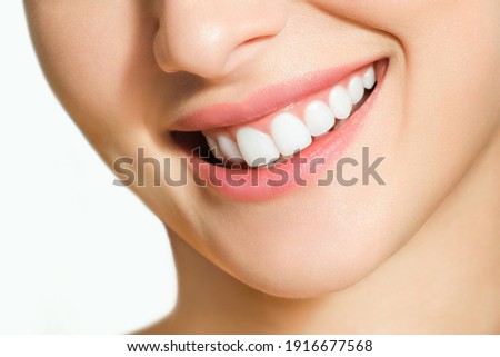 Beautiful female smile after teeth whitening procedure. Dental care. Dentistry concept. Royalty-Free Stock Photo #1916677568