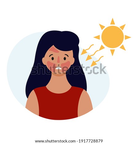 A sad girl with a sunburn on her face. Beauty and health of the skin. Vector illustration in a flat style. Royalty-Free Stock Photo #1917728879