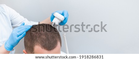 Trichoscope examination of hair, scalp and hair follicles of a young man. Copy space banner. Royalty-Free Stock Photo #1918286831