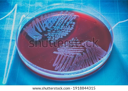 Petri plate with bacteria Steptococcus Phaemolifticus G, Streptococcus Agalactiae, Streptococcus Phaemolifticus Royalty-Free Stock Photo #1918844315