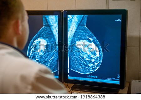 Doctor examines mammogram snapshot of breast of female patient on the monitors. Selective focus.	