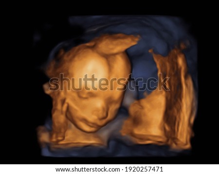 image Ultrasound 3D, 4D of baby in mother's womb. 