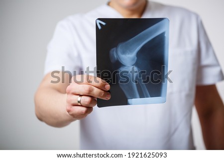 Young male doctor in a white surgical suit holds and examines an x-ray picture of the patient's leg bones .Isolated on a white background