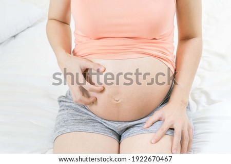 Pregnant woman scratching her belly sitting on bed at home Skin problems and pores in teenagers. Royalty-Free Stock Photo #1922670467