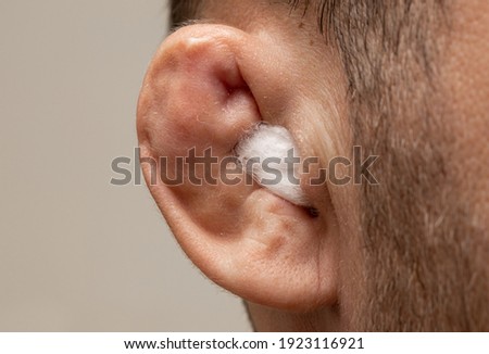 Ear of fighter close-up. Anatomy Disabled ear with medical cotton wool.