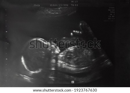 Image of baby in mother's womb during ultrasound examination at 20 weeks 2 days. Royalty-Free Stock Photo #1923767630