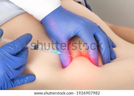 A doctor gives a girl patient an anesthetic injection, a blockade in the abdomen after a surgical operation. Concept of anesthesia in the abdomen after childbirth, epidural anesthesia Royalty-Free Stock Photo #1926907982