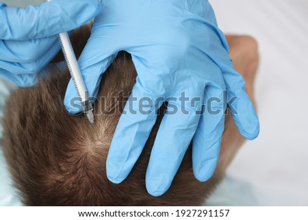 Doctor trichologist makes an injection into the scalp of man. Hair loss in men causes and treatment concept