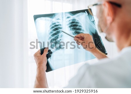 Male doctor examining the patient chest x-ray film lungs scan at radiology department in hospital.Covid-19 scan body xray test detection for covid worldwide virus epidemic spread concept. Royalty-Free Stock Photo #1929325916