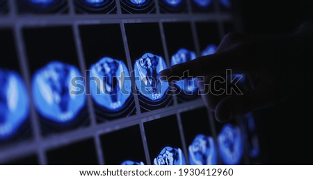 Hand pointing out specific picture in CT scan 