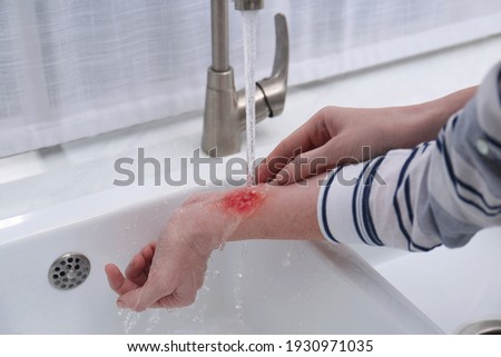 Woman holding forearm with burn under flowing water indoors, closeup Royalty-Free Stock Photo #1930971035