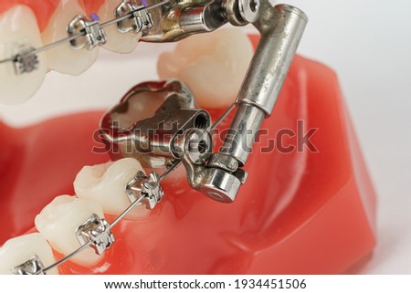 Orthodontic tools, brace, bracket system, tooth, Toothbrush