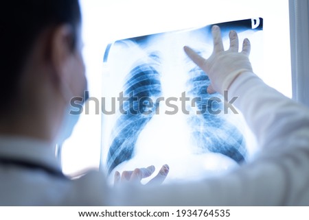Pulmonologist looking at lung x-ray prescribing treatment to patient, healthcare