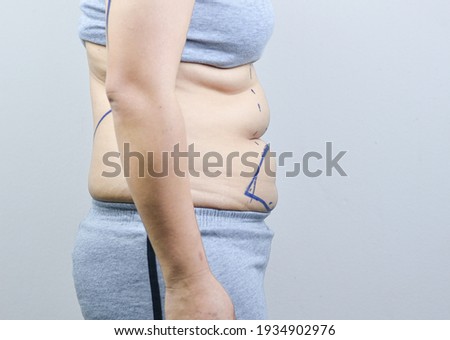 Beautiful, fat, beautiful, wear gray, suitable for medical purposes for those who want to lose weight.