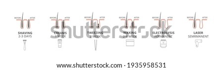 Procedure hair removal, before and after depilation a vector illustrations. Royalty-Free Stock Photo #1935958531