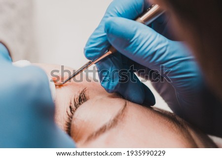 Milium on the face, removal of milia with a syringe in cosmetology. new Royalty-Free Stock Photo #1935990229