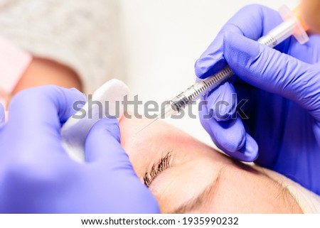 Milium on the face, removal of milia with a syringe in cosmetology. new Royalty-Free Stock Photo #1935990232