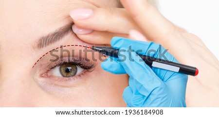 woman shows drooping eyelid for plastic surgery. Doctor plastic surgeon marks with a felt-tip pen a marker for a surgical operation Royalty-Free Stock Photo #1936184908