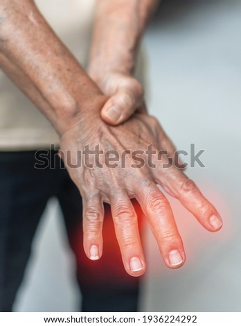 Guillain Barre syndrome, Peripheral Neuropathy pain in elderly patient on hand, finger and sensory nerves with numb, aching, muscle weakness from chronic inflammatory demyelinating polyneuropathy