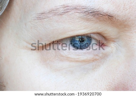middle aged female's eye with drooping eyelid. Ptosis is a drooping of the upper eyelid, lazy eye. Cosmetology and facial concept, first wrinkles, closeup Royalty-Free Stock Photo #1936920700