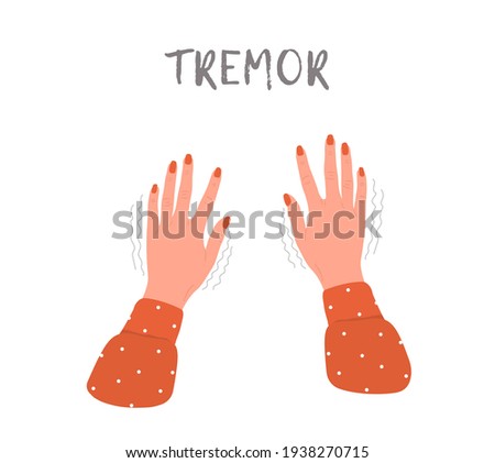 Tremor hands. Parkinson disease. Female arms with nails. Physiological stress symptoms. Vector illustration in flat cartoon style.