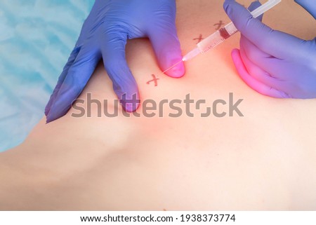 The doctor gives the patient's girl a medical injection of a blockade into the nerve plexuses of the sacro-lumbar region. Back pain treatment and pain relief concept Royalty-Free Stock Photo #1938373774
