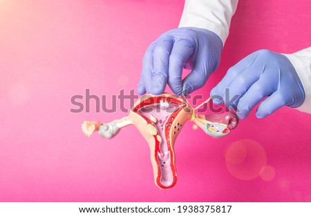 Doctor gynecologist ligates the fallopian tubes on the example of the layout of the female reproductive system, pink background. Contraception concept for unwanted pregnancy, copy space for text Royalty-Free Stock Photo #1938375817
