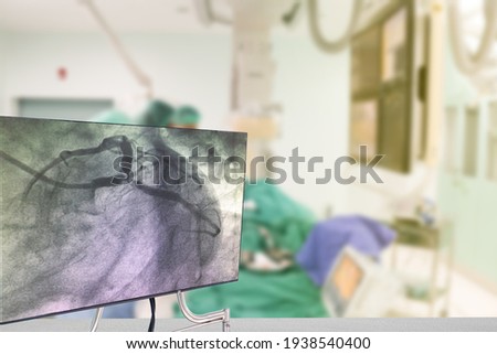 Cardiac Catheterization with Coronary Angiography on blurry  Cardiac Catherization Lab Room.
Medical healthcare and technology concept. Royalty-Free Stock Photo #1938540400
