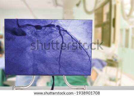 Cardiac Catheterization with Coronary Angiography on blurry  Cardiac Catherization Lab Room.Medical healthcare and Technology concept Royalty-Free Stock Photo #1938901708