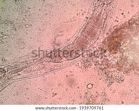 This is a strongyloides stercoralis free living stage by microscopic 40x.