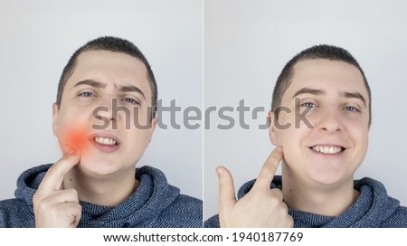 Before and after. On the left, the man indicates teeth pain, and on the right, indicates that the teeth no longer hurts. Toothache. Pain management and professional medical care assistance concept.