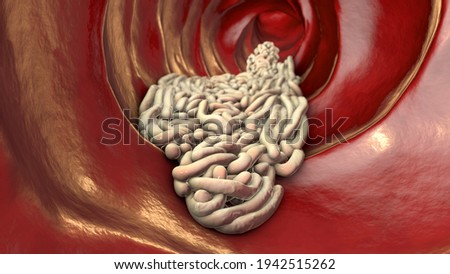 Parasitic worms in the lumen of intestine, 3D illustration. Growth and multiplication of nematode worms invading human intestine