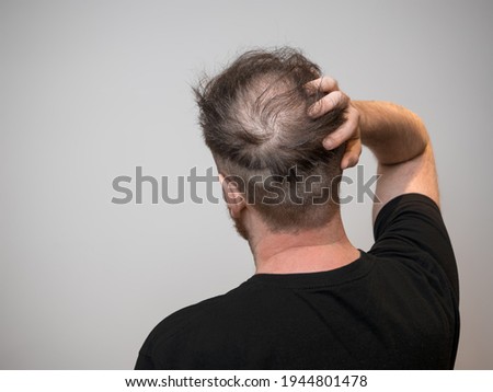A single young caucasian male checking his bald patch on the back of his head, which shows clear signs of balding and hair loss. Shot against a white background with isolated man and room for text.  Royalty-Free Stock Photo #1944801478