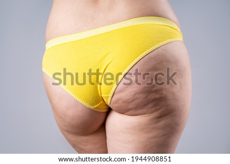 Overweight woman with fat hips and buttocks, obesity female body with cellulite on gray background, studio shot