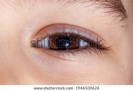 Brown-eyed baby's eye on a large scale