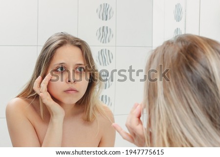 Young beautiful caucasian blonde woman looking in the bathroom mirror at her eyes with dark circles under the eyes. Bruises are caused by insomnia, fatigue, nervousness, lack of sleep and stress