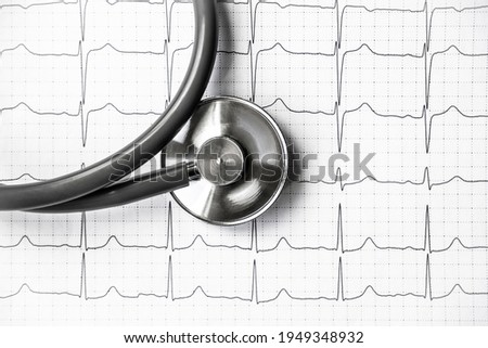 Photo of an electrocardiogram ECG or EKG printout with stethoscope. Medical health concept. Auscultation, listening to the heart pulse with a stethoscope