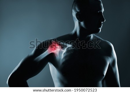 Human shoulder joint in x-ray on gray background
