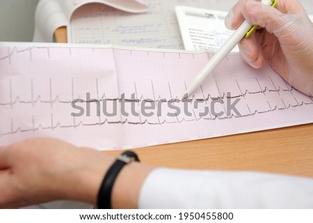 The doctor looks at the cardiogram of the heart on paper.