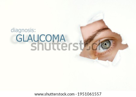Woman`s eye looking trough teared hole in paper, word Glaucoma on left. Eye disease concept template. Isolated white background. Royalty-Free Stock Photo #1951061557