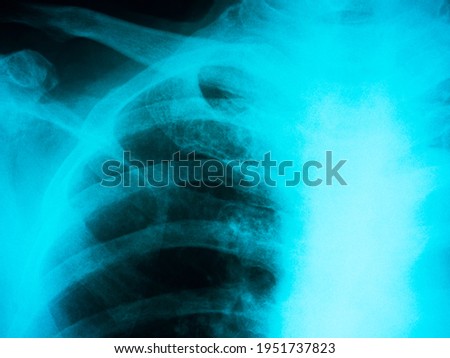 X-ray background. Close up human chest x-ray film, blue color.