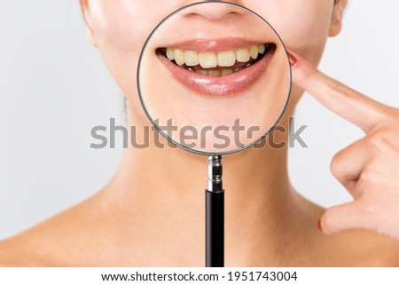Magnify yellowed teeth with a magnifying glass. Royalty-Free Stock Photo #1951743004