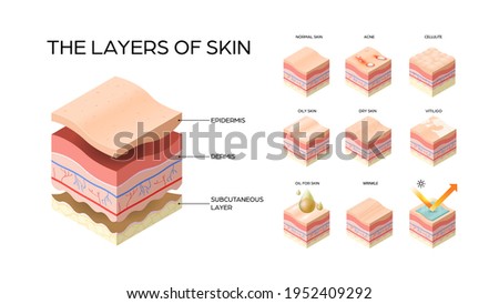 set different types skin layers cross-section of human skin structure skincare medical concept flat horizontal Royalty-Free Stock Photo #1952409292