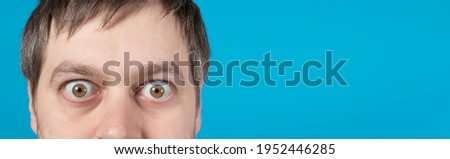 Surprised man bulging eyes on blue banner with place for text. Exophthalmos with hyperthyroidism or surprise in advertising due to discounts, sales in the store Royalty-Free Stock Photo #1952446285