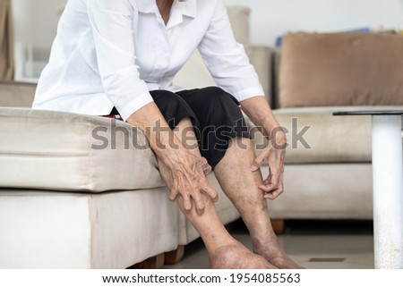 Hands of old elderly scratching legs,itching from mosquitoes,insect bites allergy or dry itchy skin, senior woman suffers from itching on legs,irritation,eczema symptoms,skin problems,skincare concept Royalty-Free Stock Photo #1954085563