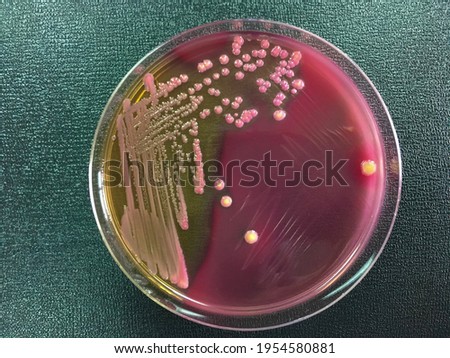 ENTEROBACTERIA Stock Photos and Images - Avopix.com