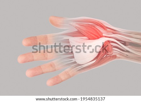 x-ray muscle hand pain from office syndrome
