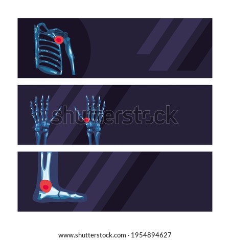Rheumatology blue bones banners set
