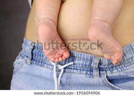 Mom with a baby in arms, the scar of a cesarean operation on stomach Royalty-Free Stock Photo #1956094906