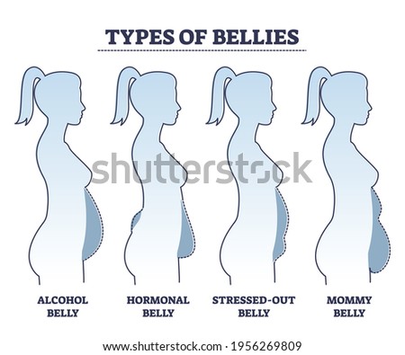 Types of bellies with abdominal fat problem in stomach area outline diagram. Collection with various body shape examples and labeled causes set vector illustration. Female overweight classification. Royalty-Free Stock Photo #1956269809